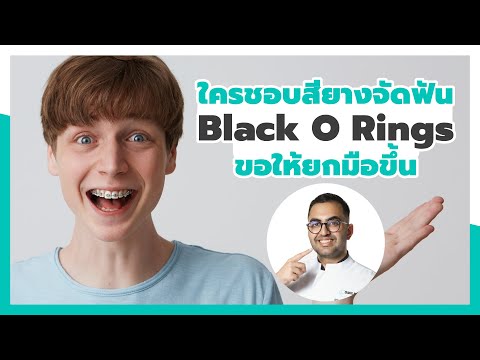 ใครชอบสียางจัดฟัน Black O Rings ขอให้ยกมือขึ้น 🙋🏻 I หมอฟัน SmileBox